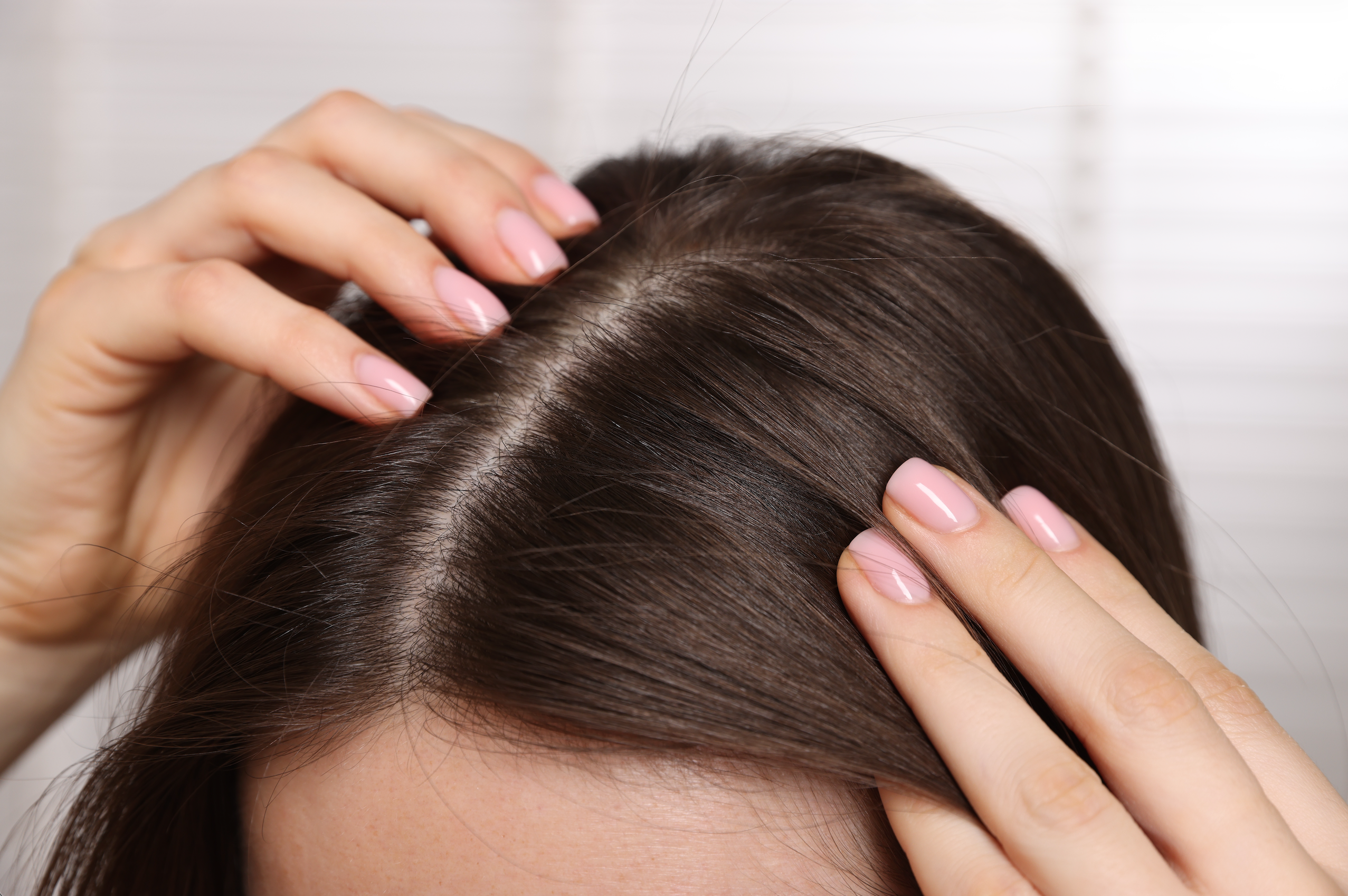 Close up of woman's scalp with dark brown hair