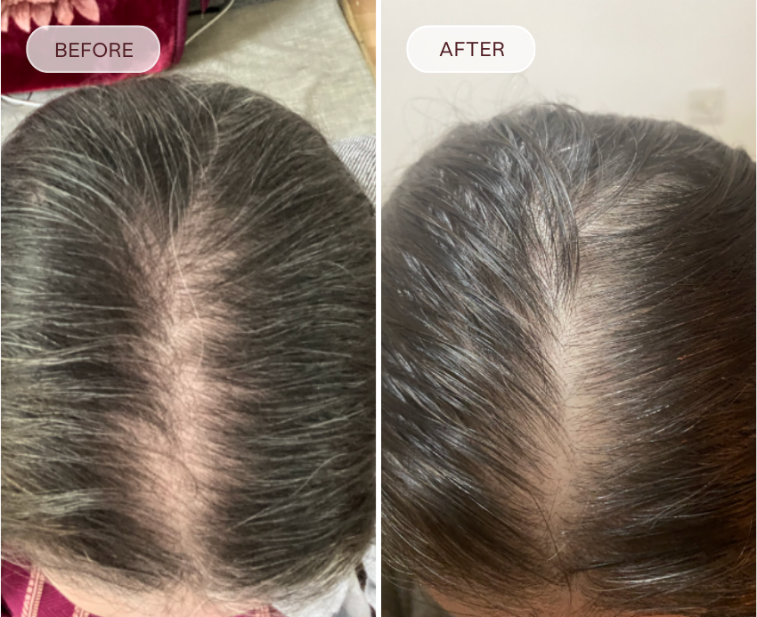 Before and after comparison of hair treatment on a person's head.