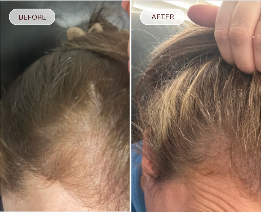 Before and after comparison of hair treatment on a person's head.