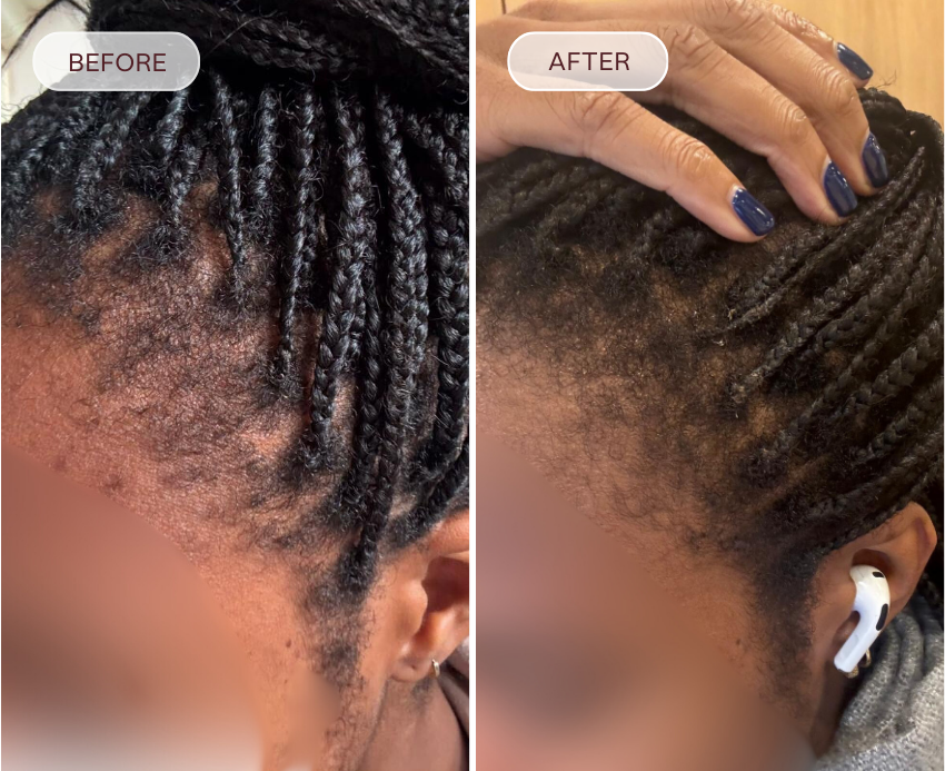 Before and after comparison of hair care product application on braided hair.