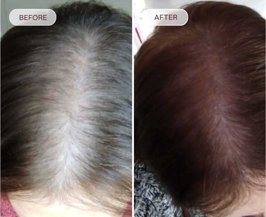 Before and after comparison of hair color on a person's head.
