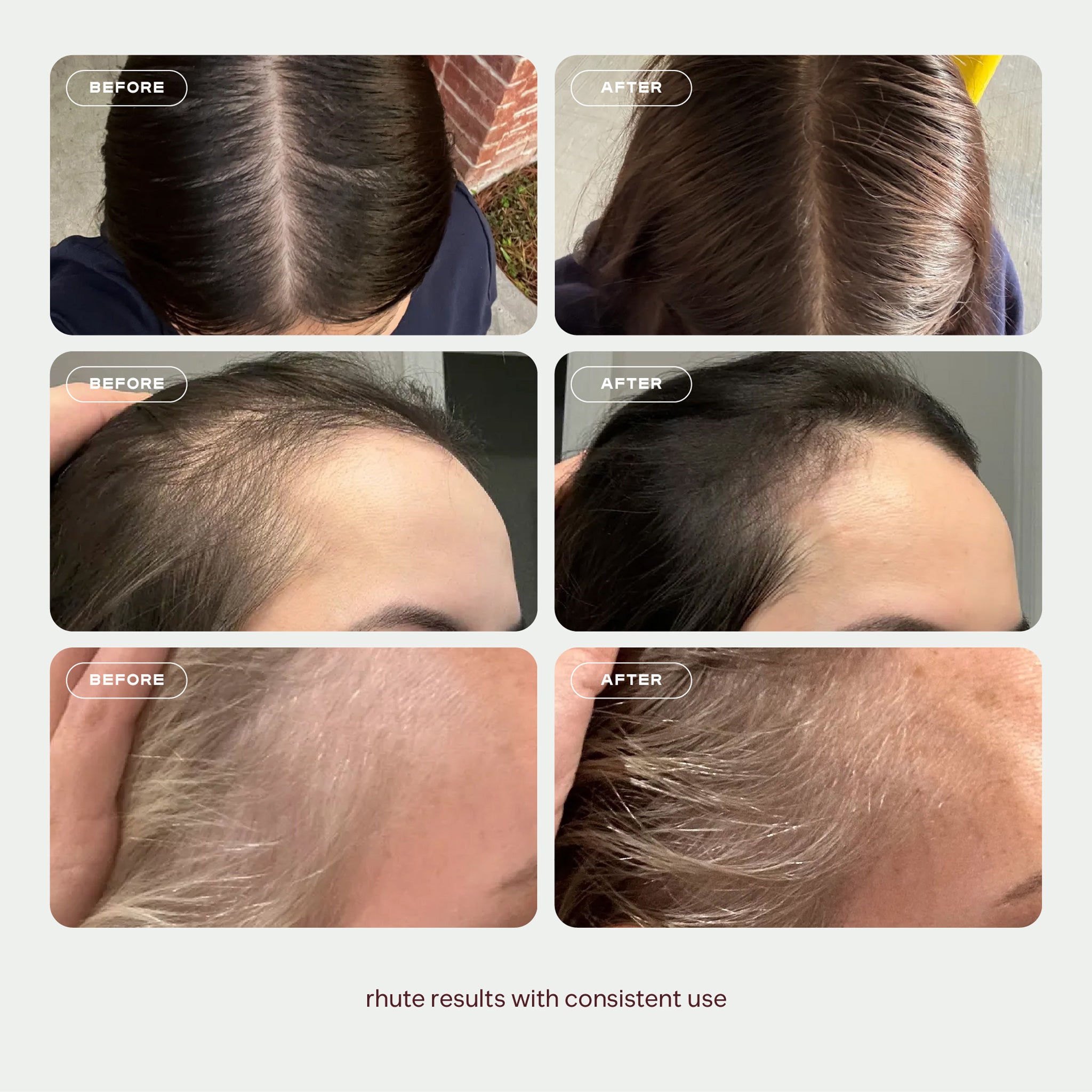 DENSITY + REPAIR | Hair Growth Scalp Serum | rhute DENSITY + REPAIR | Hair Growth Scalp Serum | rhute