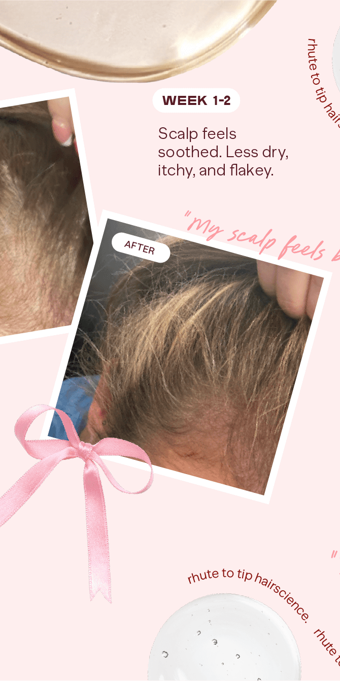 Before and after comparison of scalp health with a pink ribbon and product packaging.