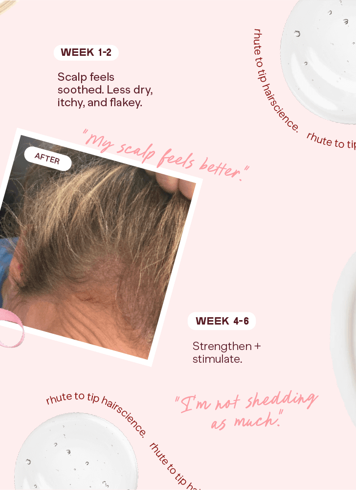 Product packaging with text and images of hair and scalp, showing before and after effects.